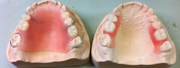 Clean Dentures Mather CA 95655